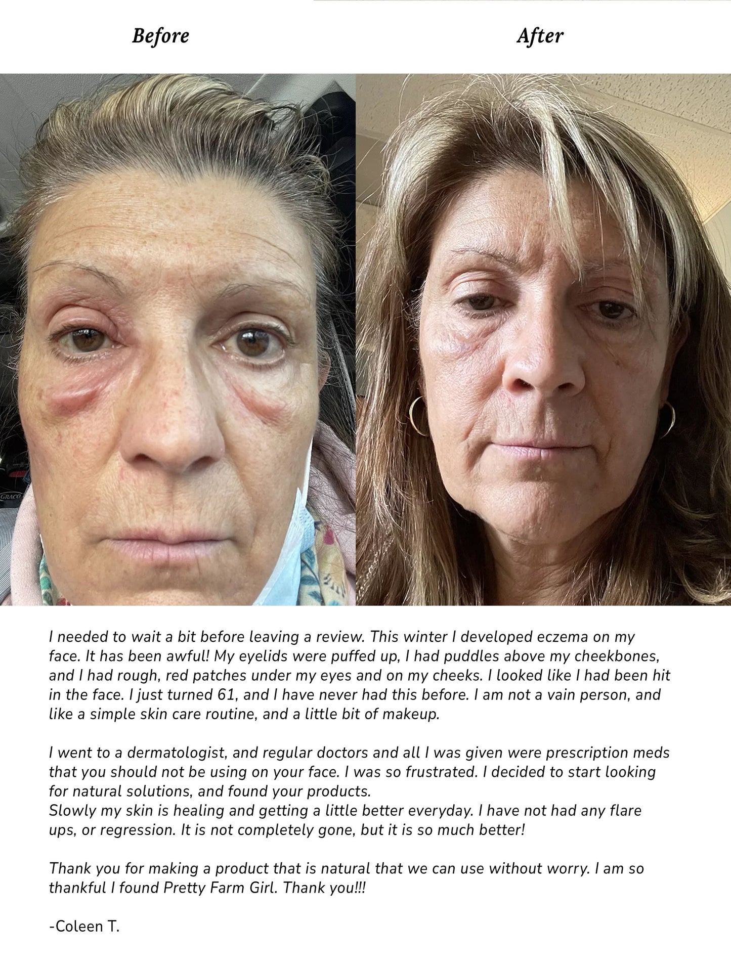 Pure Simple Skin Kit for Sensitive Skin - Blessings Grow Meadows -