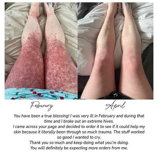 Fragrance Free Tallow + Honey Cream for Sensitive Skin - Blessings Grow Meadows