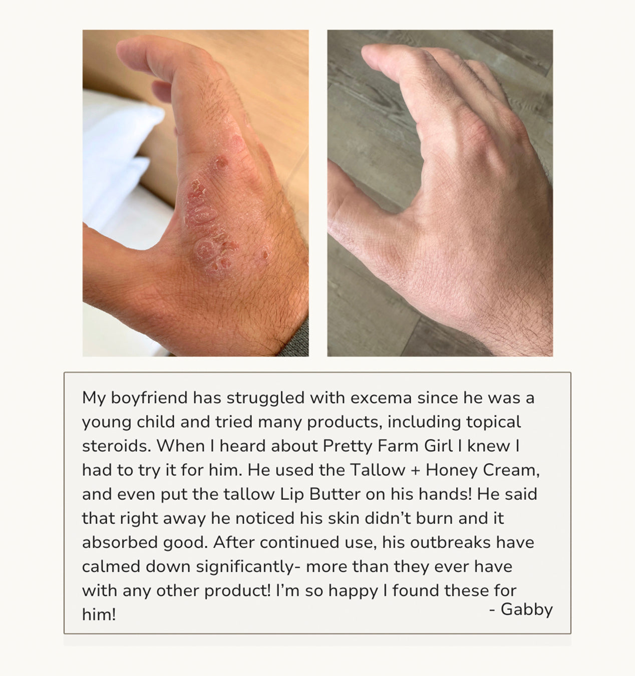 Fragrance Free Tallow + Honey Cream for Sensitive Skin - Blessings Grow Meadows